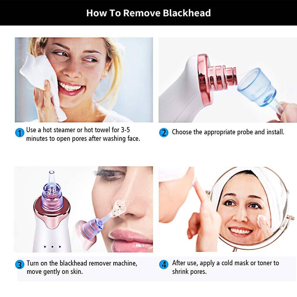 Blood circulation stimulator facial care gadget for large pores