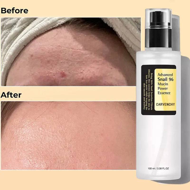 Iris Essentials snail serum collagen facial serum showing before and after skin improvement with clearer, smoother complexion