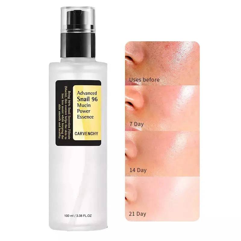 Iris Essentials snail serum collagen facial serum bottle with before and after skin improvement photos