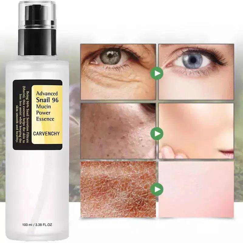 Iris Essentials snail serum collagen facial serum bottle with before and after skin improvement close-ups