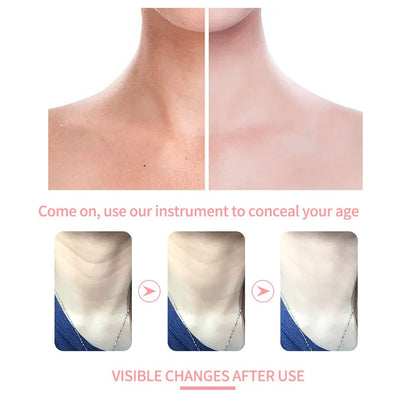 IPL Wrinkle Lift Neck Device Iris Essentials